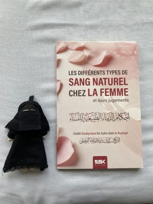 Les différents types de sang naturel chez la femme et leur jugement